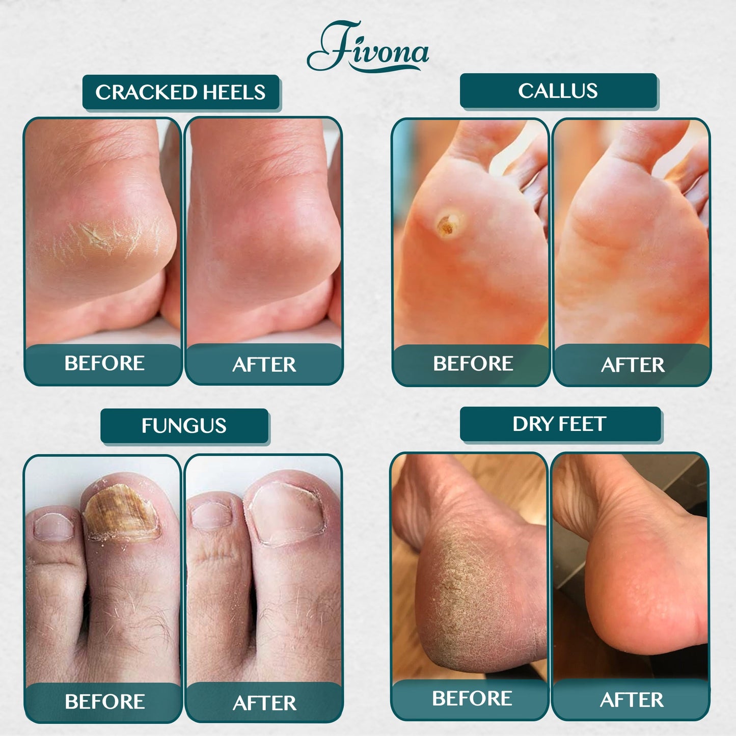 Foot Soak Blend with Tea Tree 14.1oz