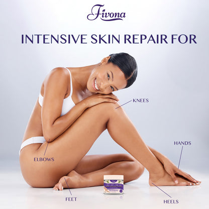 40% Urea Cream with Lavender